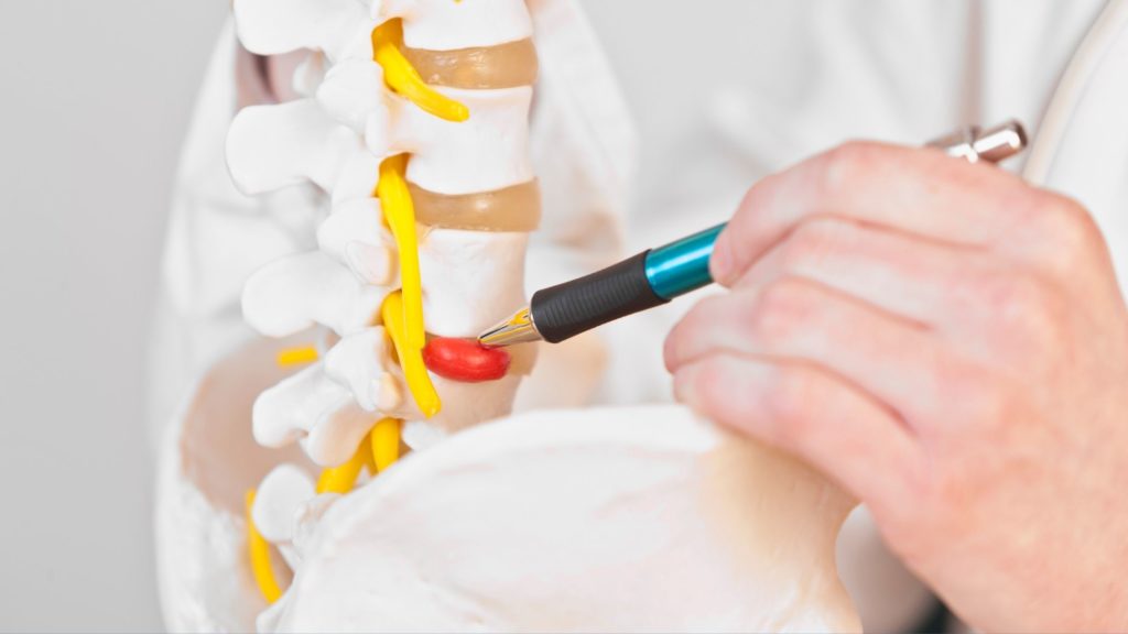 Conheça as principais doenças da coluna vertebral