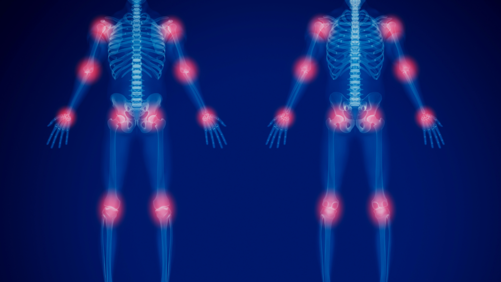 Trigger points na coluna vertebral: Causas e tratamento